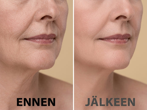 MultiBalm – Maksimaalinen täyteläisyys, välitön vaikutus