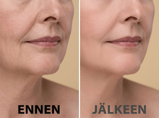 MultiBalm – Maksimaalinen täyteläisyys, välitön vaikutus