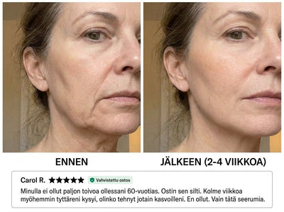 Medicube NAD+ EGF Kiinteyttävä Seerumi