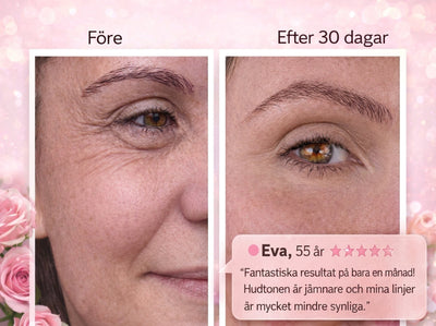 Eye Patches – Tummia silmänalusia ja silmäpusseja vastaan