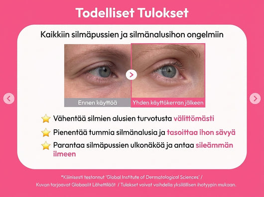 Eye Patches – Tummia silmänalusia ja silmäpusseja vastaan